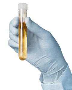 Urinalysis